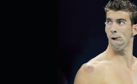 ¿Conoces la terapia china que uso Phelps en los olímpicos?